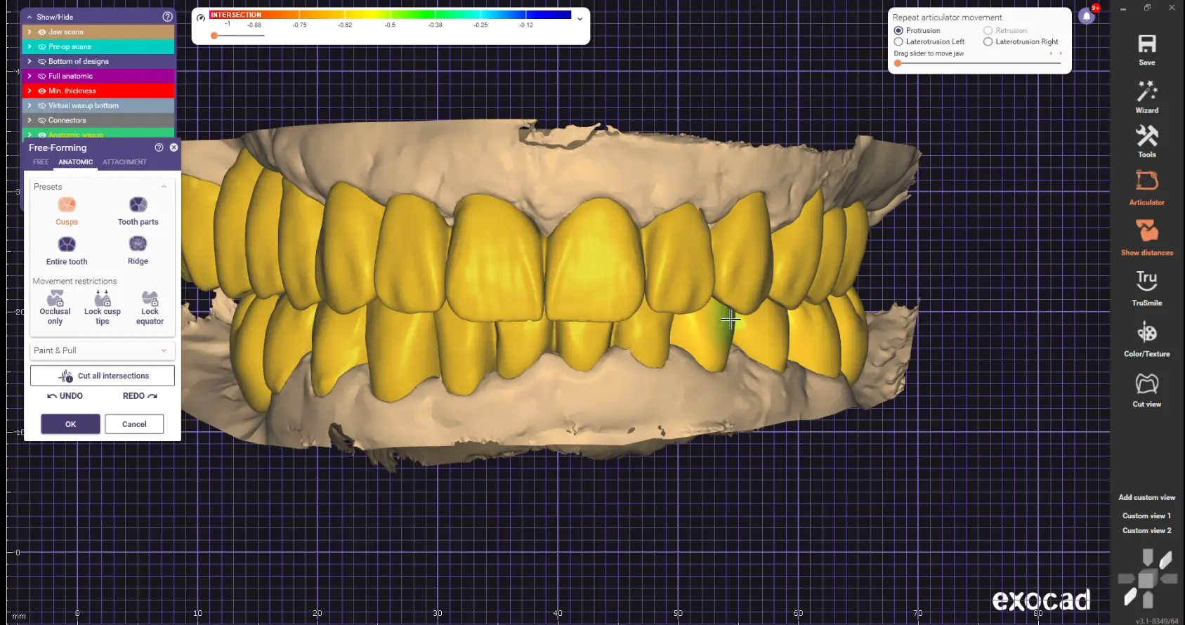 Практична работа на реални дентални случаи во Exocad