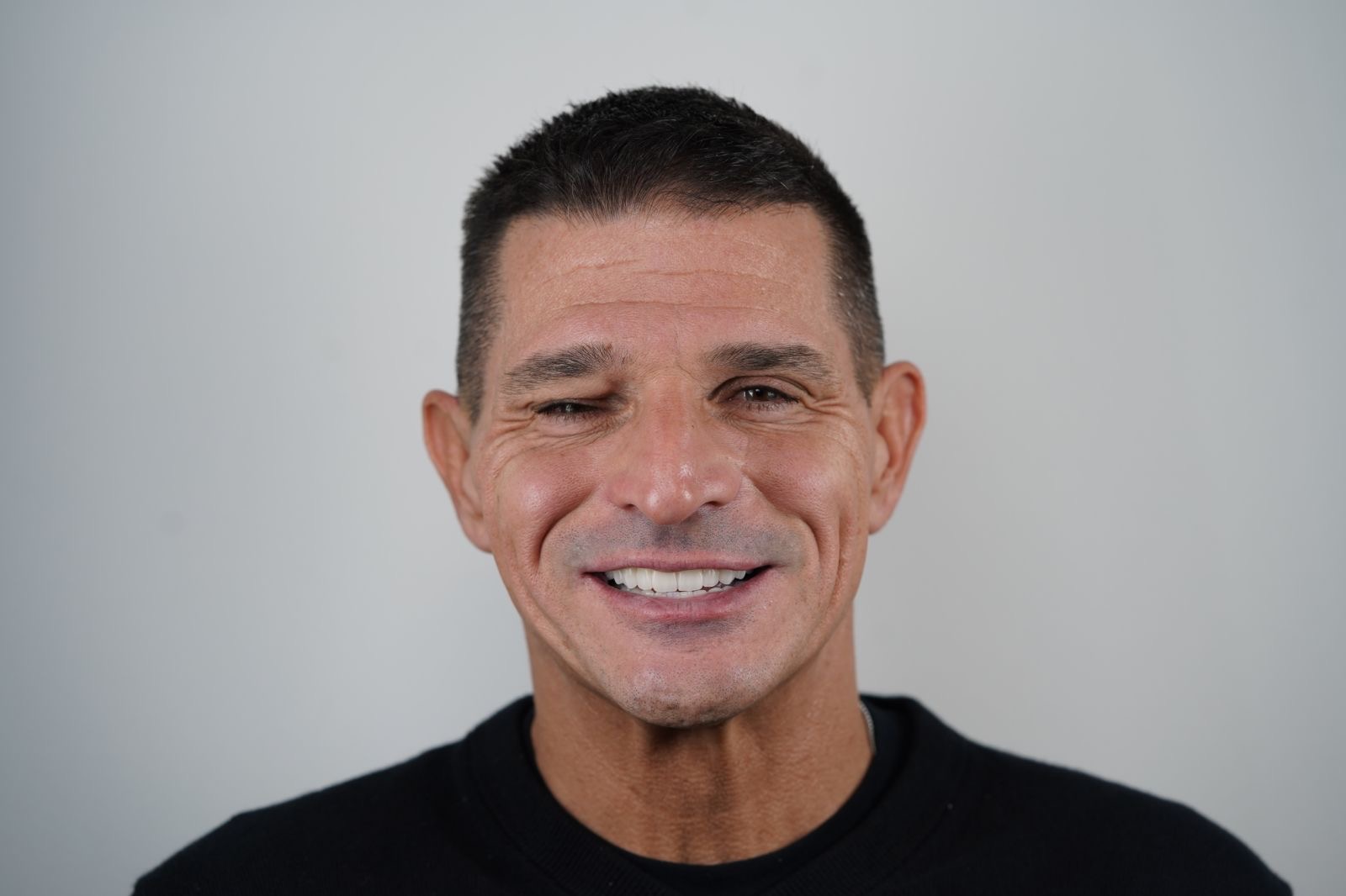 Patient after a completed prosthetic restoration